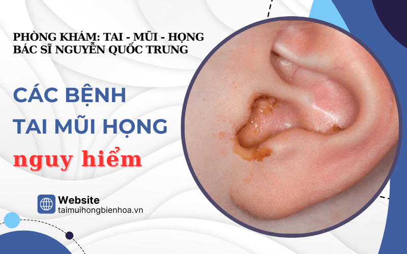 bệnh tai mũi họng