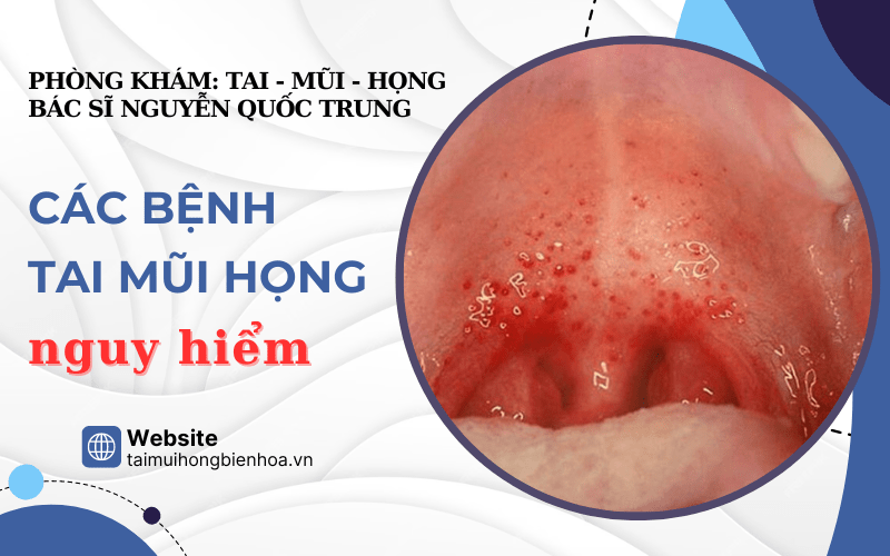 bệnh tai mũi họng