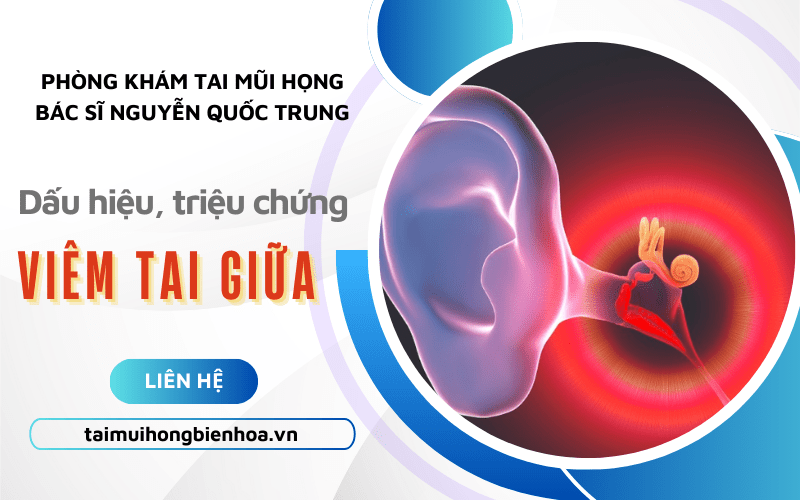 viêm tai giữa