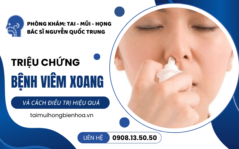 bệnh viêm xoang