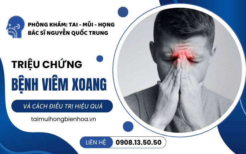 bệnh viêm xoang