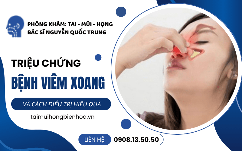 bệnh viêm xoang